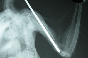 X-ray of Barred Owl showing Dr. Herman's fracture pin